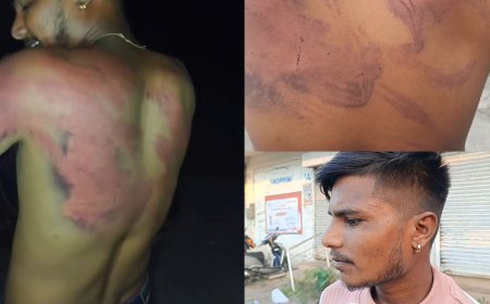 नर्मदापुरम में अवैध शराब माफिया पर युवक के साथ मारपीट का आरोप, जख्मो पर नमक और पेट्रोल डाला?