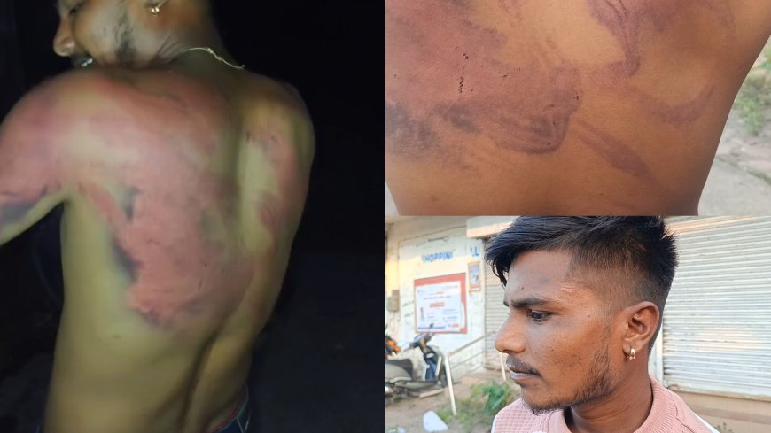 नर्मदापुरम में अवैध शराब माफिया पर युवक के साथ मारपीट का आरोप, जख्मो पर नमक और पेट्रोल डाला?